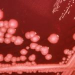 Bakterija proteus mirabilis u urinu simptomi i lečenje