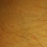 Prirodno uklanjanje dlačica – depilacija šećernom pastom, kurkumom, papajom
